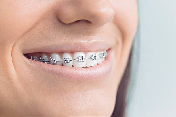 Best Veneers and Lumineers  in Mcleansboro, IL
